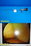 Richard Wolf Panoview Plus 8880.402 25 Arthroscope Rigid Telescope 30220 Used. Price: $359.99.