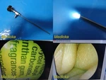 Richard Wolf Panoview Plus 8880.402 Rigid Telescope 4MM X 25 26699 Used. Price: $359.99.